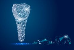 Mitigating Risks Associated With Dental Implant Procedures